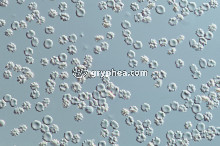 Hématies en milieu hypertonique (sang humain) x160 - gryphea.org